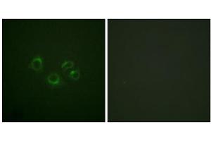 Immunofluorescence analysis of A549 cells, using EPHA2/3/4 (epitope around residue 588/596) antibody. (EPHA2/3/4 Antikörper  (Tyr588, Tyr596))