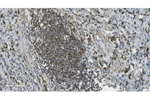 IHC analysis of PARP using anti-PARP antibody (ABIN7602278). (PARP1 Antikörper  (AA 670-858))