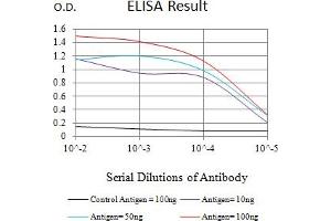 Black line: Control Antigen (100 ng),Purple line: Antigen (10 ng), Blue line: Antigen (50 ng), Red line:Antigen (100 ng)