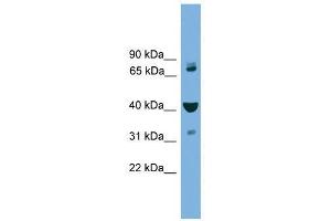 Western Blot showing VPS16 antibody used at a concentration of 1-2 ug/ml to detect its target protein. (VPS16 Antikörper  (Middle Region))