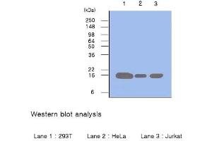 Cell lysates of 293T, HeLa and Jurkat (each 50 µg) were resolved by SDS-PAGE, transferred to PVDF membrane and probed with anti-human Pin1 (1:500). (PIN1 Antikörper  (N-Term))