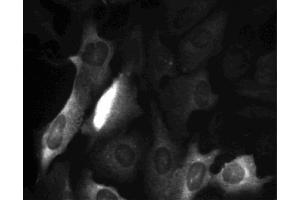 Cyclin B1 staining of U-2 OS (ATCC HTB-96) cells. (Cyclin B1 Antikörper  (AA 1-21))