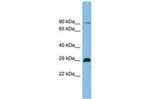 Image no. 1 for anti-Chromatin Target of PRMT1 (CHTOP) (AA 71-120) antibody (ABIN6745086)