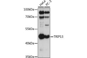 Western blot analysis of extracts of various cell lines, using TRIP13 antibody (ABIN7270823) at 1:1000 dilution. (TRIP13 Antikörper  (AA 1-120))