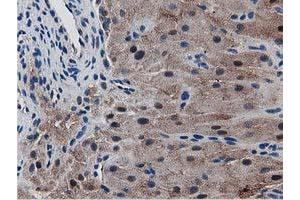 Image no. 2 for anti-Sequestosome 1 (SQSTM1) antibody (ABIN1499988) (SQSTM1 Antikörper)