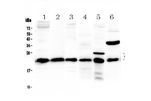 Western blot analysis of PARK7 / DJ1 using anti-PARK7 / DJ1 antibody . (PARK7/DJ1 Antikörper  (AA 2-189))