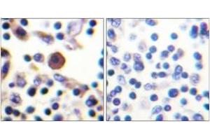 Immunohistochemistry (IHC) image for anti-Interleukin 9 Receptor (IL9R) (AA 472-521) antibody (ABIN2888887) (IL9 Receptor Antikörper  (AA 472-521))