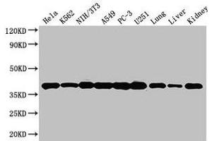 Western Blot Positive WB detected in: Hela whole cell lysate, K562 whole cell lysate, NIH/3T3 whole cell lysate, A549 whole cell lysate, PC-3 whole cell lysate, U251 whole cell lysate, Mouse lung tissue, Mouse liver tissue, Mouse kidney tissue All lanes: ANXA2 antibody at 3 μg/mL Secondary Goat polyclonal to rabbit IgG at 1/50000 dilution Predicted band size: 39, 41 kDa Observed band size: 39 kDa (Annexin A2 Antikörper  (AA 2-339))