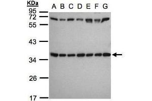 WB Image Sample(30 ug whole cell lysate) A: 293T B: A431 , C: H1299 D: HeLa S3 , E: Hep G2 , F: MOLT4 , G: Raji , 12% SDS PAGE antibody diluted at 1:1000 (RPS3A Antikörper)
