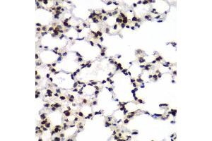Immunohistochemistry of paraffin-embedded mouse lung using TEAD1 antibody at dilution of 1:100 (x40 lens). (TEAD1 Antikörper)