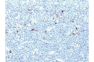Formalin-fixed, paraffin-embedded human tonsil stained with HLA-Aw32 / HLA-A25 antibody (CATA-1). (HLA-Aw32-&-HLA-A25 (MHC-I) Antikörper)
