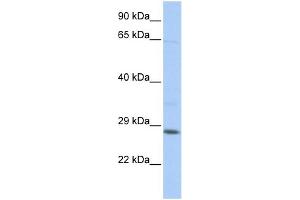 WB Suggested Anti-TGIF2LX Antibody Titration:  0. (TGIF2LX Antikörper  (Middle Region))