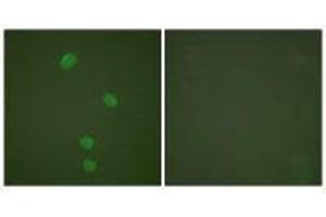 Immunofluorescence analysis of HepG2 cells, using MCM5 antibody. (MCM5 Antikörper)