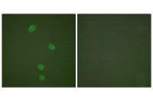 Immunofluorescence analysis of HepG2 cells, using MCM5 antibody. (MCM5 Antikörper)