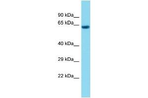 Host: Rabbit Target Name: C1orf94 Sample Type: Fetal Heart lysates Antibody Dilution: 1. (C1ORF94 Antikörper  (C-Term))