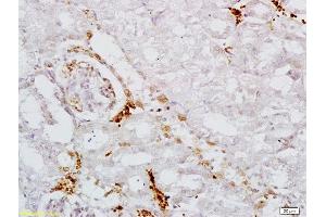 Formalin-fixed and paraffin embedded mouse kidney labeled with Anti AAK1 Polyclonal Antibody, Unconjugated  at 1:200 followed by conjugation to the secondary antibody and DAB staining (AAK1 Antikörper  (AA 301-400))