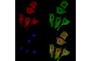 ABIN6261731 and ABIN6269136 staining HepG2 cells by IF/ICC. (FGFR1 Antikörper  (C-Term))