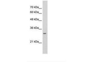 Image no. 1 for anti-Stem-Loop Binding Protein (SLBP) (AA 142-191) antibody (ABIN6736294) (SLBP Antikörper  (AA 142-191))