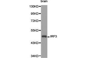 Western Blotting (WB) image for anti-Interferon Regulatory Factor 3 (IRF3) antibody (ABIN1873267) (IRF3 Antikörper)