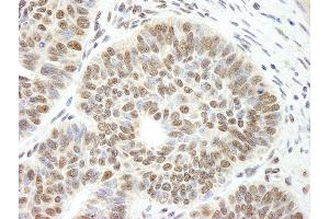 anti-Cell Division Cycle and Apoptosis Regulator 1 (CCAR1) (AA 1-50) antibody