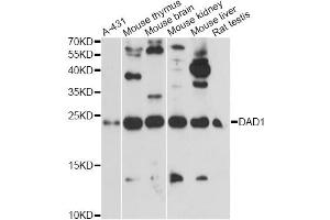 Western blot analysis of extracts of various cell lines, using DAD1 antibody. (DAD1 Antikörper)
