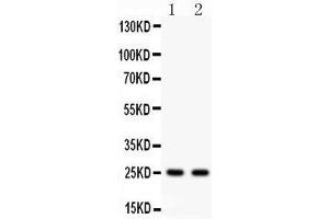Anti- Rab3A Picoband antibody, Western blotting All lanes: Anti Rab3A  at 0. (RAB3A Antikörper  (C-Term))