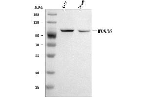 Western blot analysis of WDR36 using anti-WDR36 antibody (ABIN7602409). (WDR36 Antikörper  (AA 74-865))