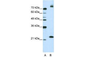 WB Suggested Anti-FZD9 Antibody Titration:  2. (FZD9 Antikörper  (N-Term))