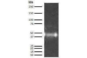 Western Blotting (WB) image for anti-Orosomucoid 1 (ORM1) antibody (ABIN613603) (ORM1 Antikörper)
