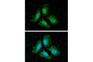 ICC/IF analysis of PPP1CA in HeLa cells line, stained with DAPI (Blue) for nucleus staining and monoclonal anti-human PPP1CA antibody (1:100) with goat anti-mouse IgG-Alexa fluor 488 conjugate (Green). (PPP1CA Antikörper)