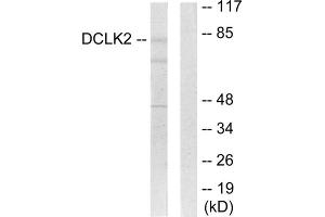 Western blot analysis of extracts from HepG2 cells, using DCLK2 antibody. (DCLK2 Antikörper  (N-Term))