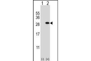 Western blot analysis of GSTT1 (arrow) using rabbit polyclonal GSTT1 Antibody (N-term) (ABIN656825 and ABIN2846035).