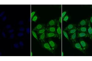 Detection of HDAC6 in Human HepG2 cell using Polyclonal Antibody to Histone Deacetylase 6 (HDAC6) (HDAC6 Antikörper  (AA 560-811))