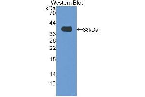 Western blot analysis of the recombinant protein. (MTFMT Antikörper  (AA 78-386))