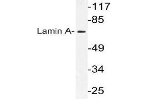 Western blot (WB) analysis of Lamin A antibody in extracts from HeLa cells. (Lamin A/C Antikörper)