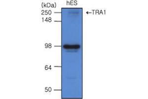 Western blot analysis: The cell lysates of hES(20ug) were resolved by SDS-PAGE, transferred to PVDF membrane and probed with antihuman TRA 1 (1:500). (GRP94 Antikörper)
