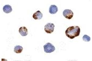Immunohistochemistry (IHC) image for anti-P21 Protein (Cdc42/Rac)-Activated Kinase 7 (PAK7) (Middle Region) antibody (ABIN1031031)