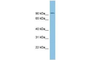 TLK1 antibody used at 1 ug/ml to detect target protein. (TLK1 Antikörper  (Middle Region))