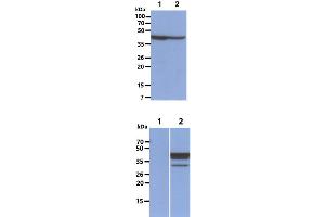 The Cell lysates (40ug) were resolved by SDS-PAGE, transferred to PVDF membrane and probed with anti-human FUS2 antibody (1:1000). (NAT6 Antikörper)