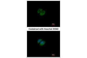 ICC/IF Image Immunofluorescence analysis of methanol-fixed A549, using HPRT, antibody at 1:500 dilution. (HPRT1 Antikörper)