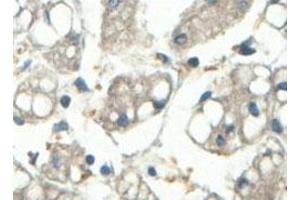 Immunohistochemical analysis of paraffin-embedded human fetal liver showing cytoplasmic staining with ABCF3 polyclonal antibody  at a 1 : 100 dilution. (ABCF3 Antikörper  (AA 442-681))