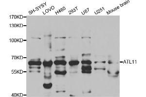 Western blot analysis of extracts of various cell lines, using ATL1 antibody (ABIN5973048) at 1/1000 dilution. (ATL1 Antikörper)