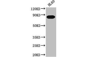 Western Blot Positive WB detected in: HL60 whole cell lysate All lanes: PREP antibody at 1:2000 Secondary Goat polyclonal to rabbit IgG at 1/50000 dilution Predicted band size: 81 kDa Observed band size: 81 kDa (PREP Antikörper  (AA 539-691))