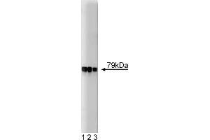 Western Blotting (WB) image for anti-A Kinase (PRKA) Anchor Protein 5 (AKAP5) (AA 180-427) antibody (ABIN967900)