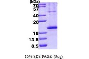 Image no. 1 for Tumor Necrosis Factor Receptor Superfamily, Member 13B (TNFRSF13B) protein (His tag) (ABIN1098781)