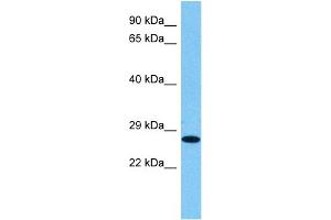 Host:  Rat  Target Name:  HMGB1  Sample Tissue:  Rat Skeletal Muscle  Antibody Dilution:  1ug/ml (HMGB1 Antikörper  (N-Term))