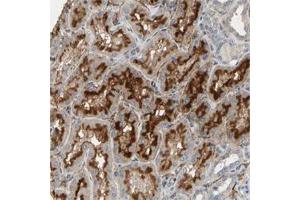 Immunohistochemical staining of human kidney with SUSD2 polyclonal antibody  show strong cytoplasmic and membranous positivity in cells in tubules at 1:200-1:500 dilution. (SUSD2 Antikörper)