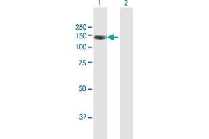 Western Blot analysis of KIAA1967 expression in transfected 293T cell line by KIAA1967 MaxPab polyclonal antibody. (CCAR2 Antikörper  (AA 1-923))