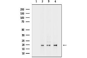 Western blot analysis of lysates from various samples, using DDI/CHOP mouse monoclonal Antibody.