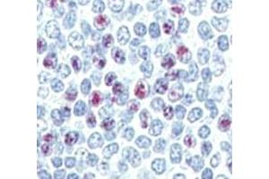 Immunohistochemistry (IHC) image for anti-Lin-28 Homolog B (LIN28B) (AA 95-128) antibody (ABIN3031627)